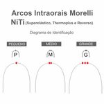 5060013_grande-arco-niti-ok.jpg