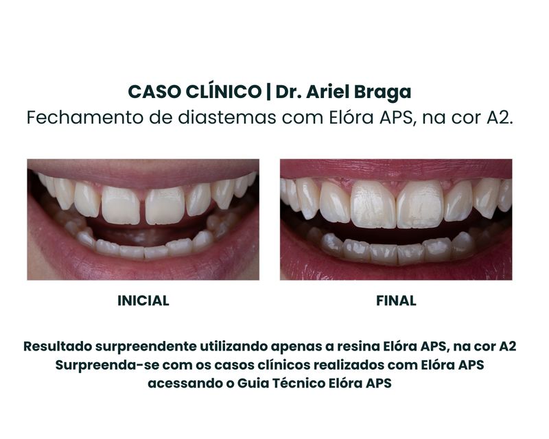 Copia-de--Clinica-Medica-Simples-Azul-e-Branco-Instagram-Post--1080-x-1350-px---1500-x-1200-px---1-.jpg