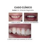 Copia-de--Clinica-Medica-Simples-Azul-e-Branco-Instagram-Post--1080-x-1350-px---1500-x-1200-px---12-.jpg