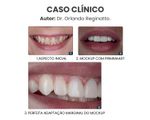 Copia-de--Clinica-Medica-Simples-Azul-e-Branco-Instagram-Post--1080-x-1350-px---1500-x-1200-px---12-.jpg