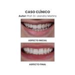 Copia-de--Clinica-Medica-Simples-Azul-e-Branco-Instagram-Post--1080-x-1350-px---1500-x-1200-px---17-.jpg