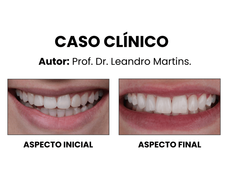 Copia-de--Clinica-Medica-Simples-Azul-e-Branco-Instagram-Post--1080-x-1350-px---1500-x-1200-px---1-.png