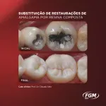 D_NQ_NP_675060-MLB70299351395_072023-O-kit-resina-llis-c4-escolha-as-cores-fgm.webp