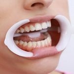 demontracao-de-uso-do-afastador-labial-arcflex-fgm-dc11377-dental-cremer.jpg