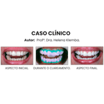 Copia-de--Clinica-Medica-Simples-Azul-e-Branco-Instagram-Post--1080-x-1350-px---1500-x-1200-px---4-.png