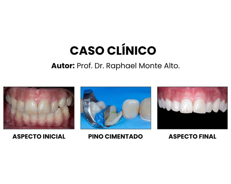 Copia-de--Clinica-Medica-Simples-Azul-e-Branco-Instagram-Post--1080-x-1350-px---1500-x-1200-px---6-.jpg