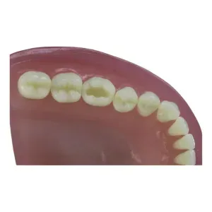 Dente manequim Pronew - Pronew