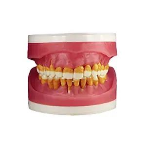 Arcada manequim cirurgia com dentes de periodontia AC 025 - Pronew